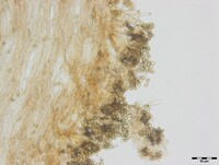 Sarophorum palmicola image