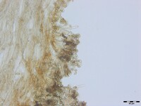 Sarophorum palmicola image