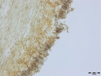 Sarophorum palmicola image