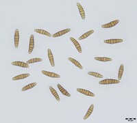Oedohysterium sinense image