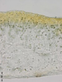 Collema pulchellum var. subnigrescens image