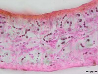 Collema pulchellum var. subnigrescens image