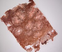 Eremiomyces echinulatus image