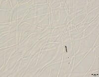 Macrovalsaria megalospora image