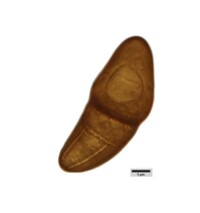 Macrovalsaria megalospora image