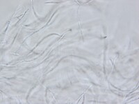 Macrovalsaria megalospora image