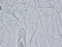 Macrovalsaria megalospora image
