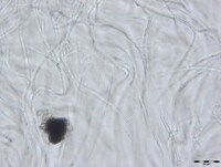 Macrovalsaria megalospora image
