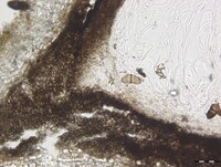 Macrovalsaria megalospora image