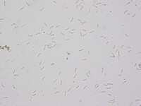 Diatrypella atlantica image