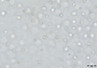 Sirobasidium magnum image