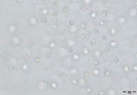 Sirobasidium magnum image