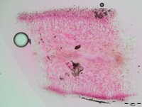 Sirobasidium magnum image