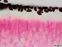 Sirobasidium magnum image