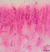 Sirobasidium magnum image