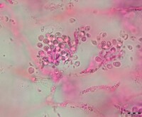 Sirobasidium magnum image