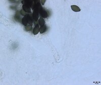 Podospora setosa image
