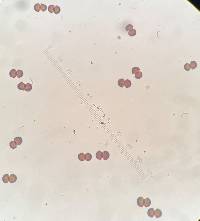 Mycosyrinx cissi image