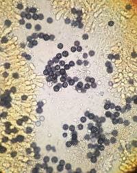 Zelleromyces ravenelii image
