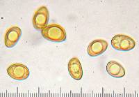 Pseudosperma squamatum image