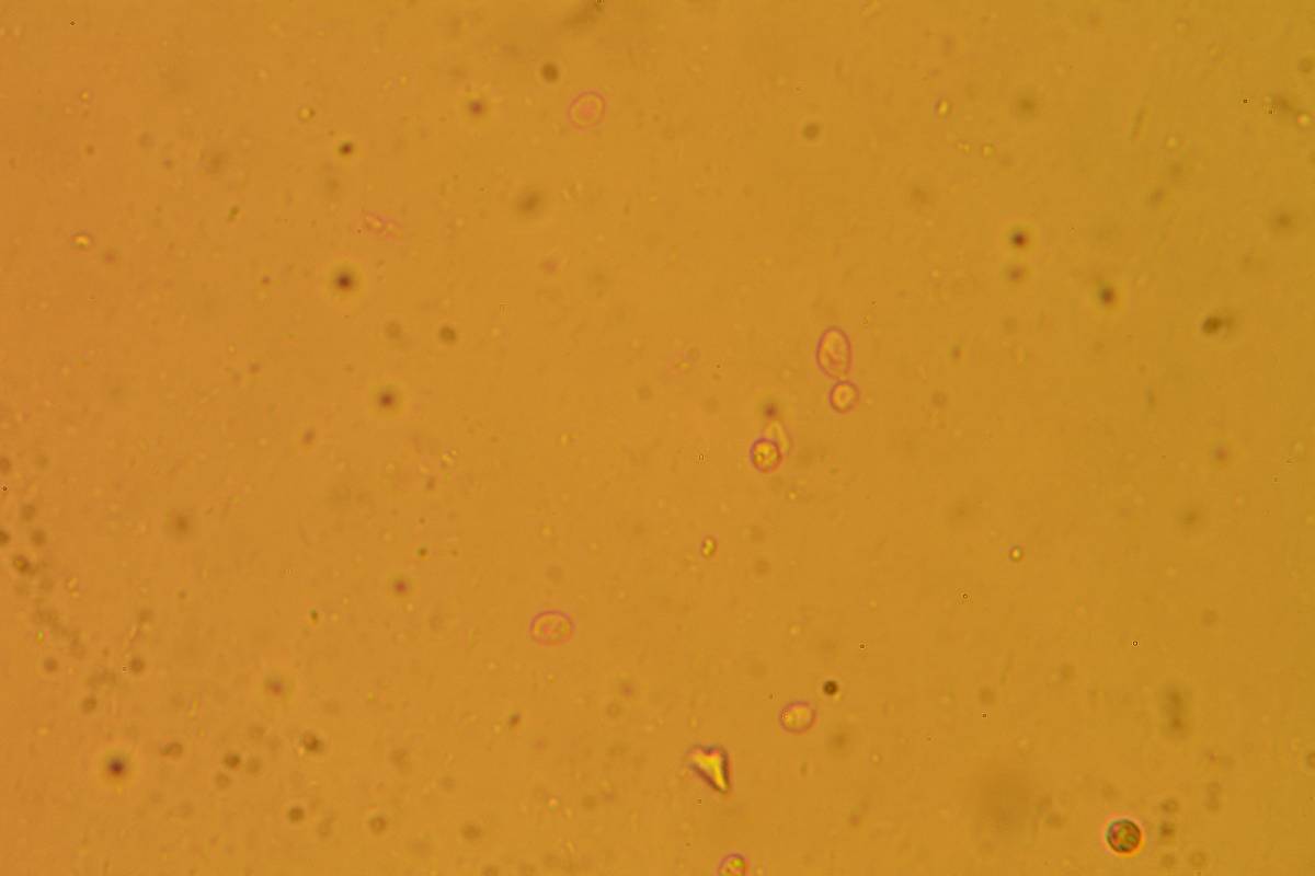 Hodophilus peckianus image