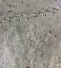 Tubulicrinis accedens image