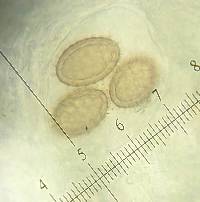 Tuber brennemanii image