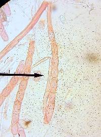 Wolfina aurantiopsis image