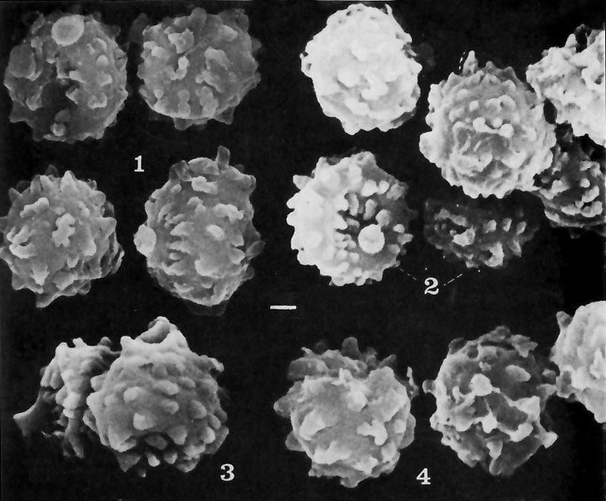 Tulostoma bruchii image