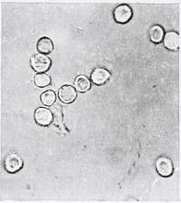 Tulostoma striatum image