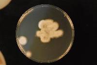 Image of Aspergillus calidoustus