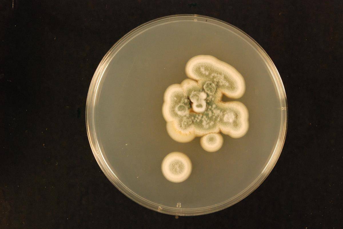 Aspergillus tabacinus image