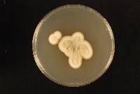 Aspergillus tabacinus image