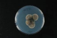 Pyrenochaetopsis leptospora image