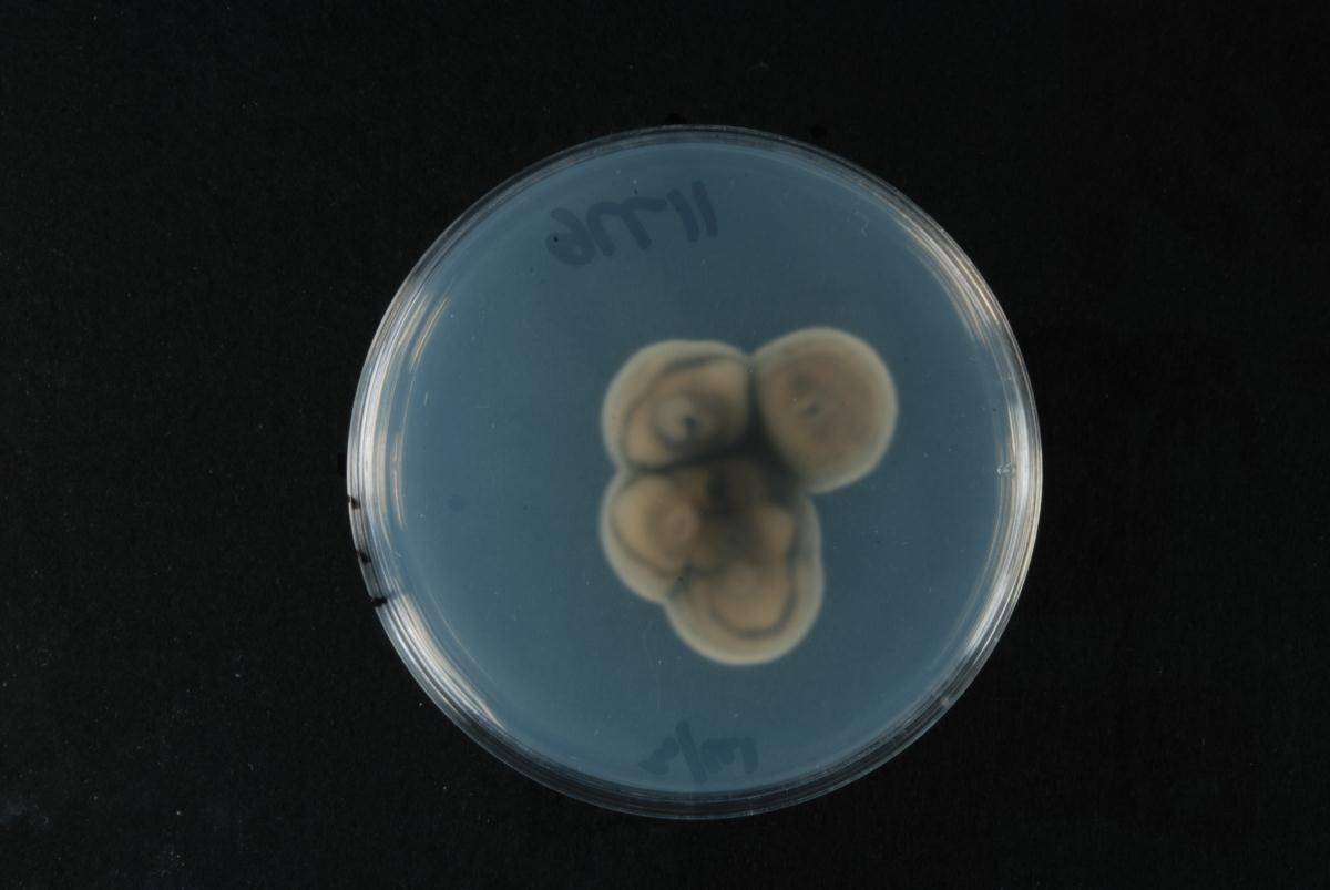 Pyrenochaetopsis leptospora image