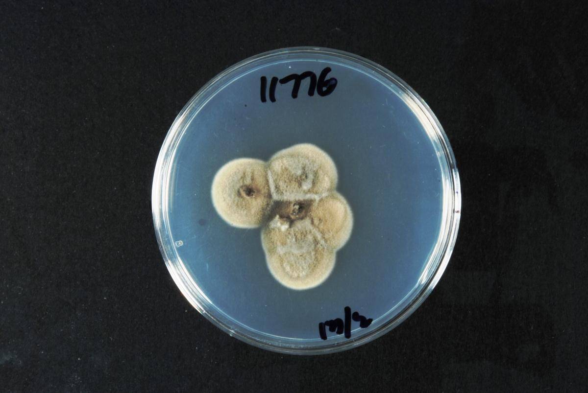 Pyrenochaetopsis leptospora image