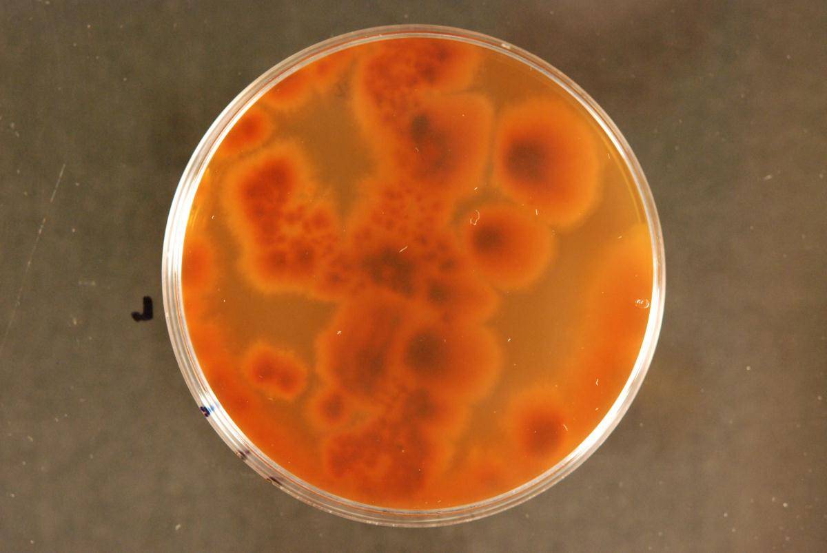 Herpotrichiellaceae image