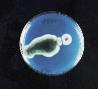 Phaeomoniella chlamydospora image