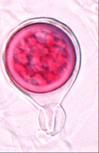 Phytophthora agathidicida image