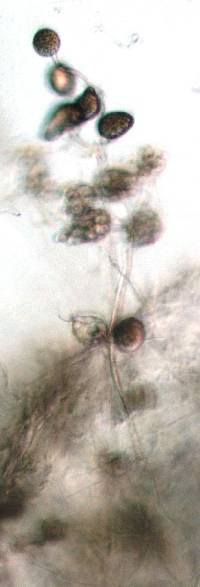Phytophthora agathidicida image