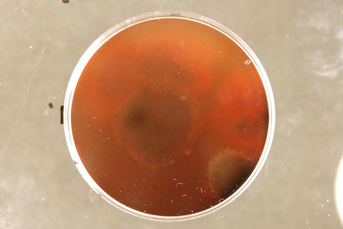 Cryptophiale udagawae image