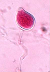 Phytophthora cocois image