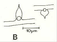 Hyphodontia subalutacea image