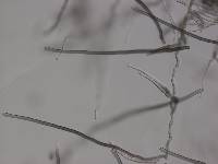 Cercospora apii image