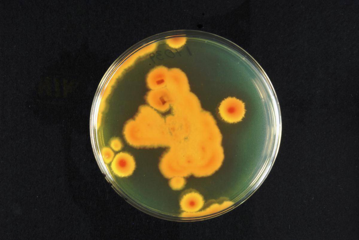 Phaeoacremonium globosum image