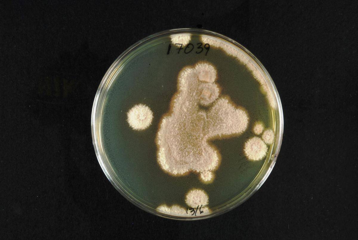 Phaeoacremonium globosum image