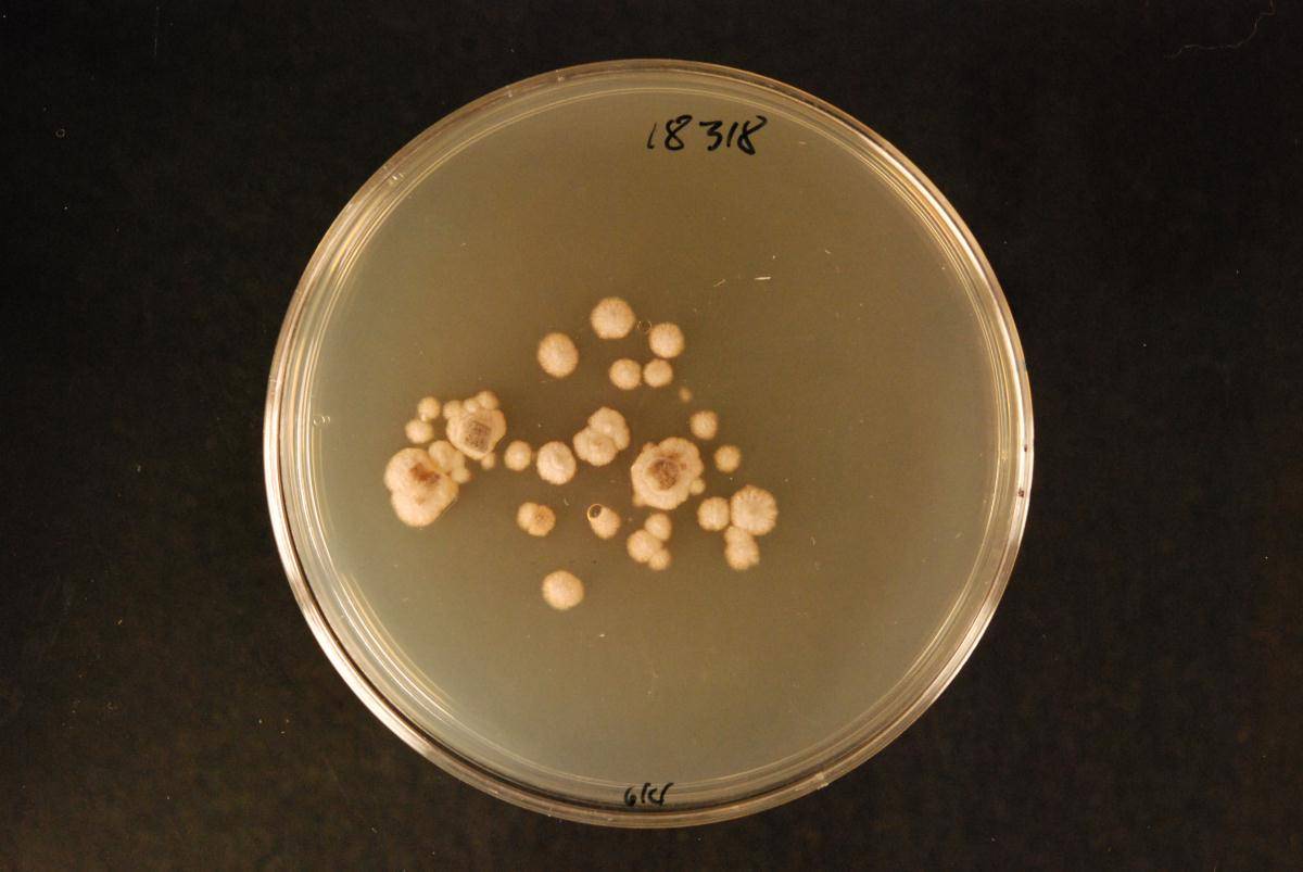 Coccomyces cupressini image