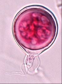 Phytophthora agathidicida image