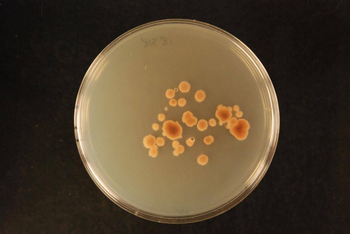 Coccomyces cupressini image