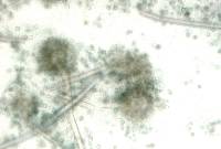 Aspergillus sydowii image